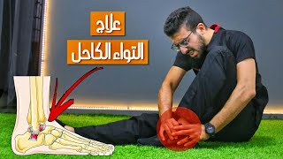 إلتواء الكاحل درجات الإصابة والعلاج الطبيعى | ankle sprain | دكتور حازم طارق