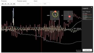 Blackbox Log Analysis: andrenoites - 2/20 Wealth