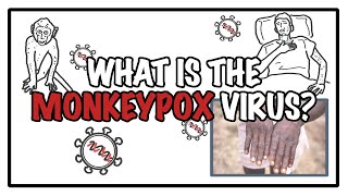 What is the Monkeypox virus?