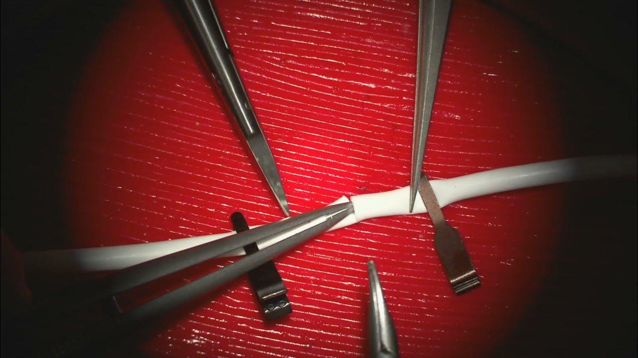 EndToEnd Microanastomosis Tips and Techniques YouTube
