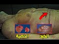 أول تشريح جثـــة لاعب كمال اجسام ويراها العالم اندرياس موينسر
