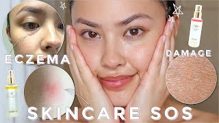 My Current and Best Skincare Tips I'm Currently Doing | *eczema, bites, and dry, itchy skin*