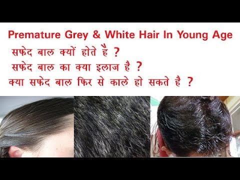 10 Causes Of White Hair And 12 Ways To Prevent It Naturally