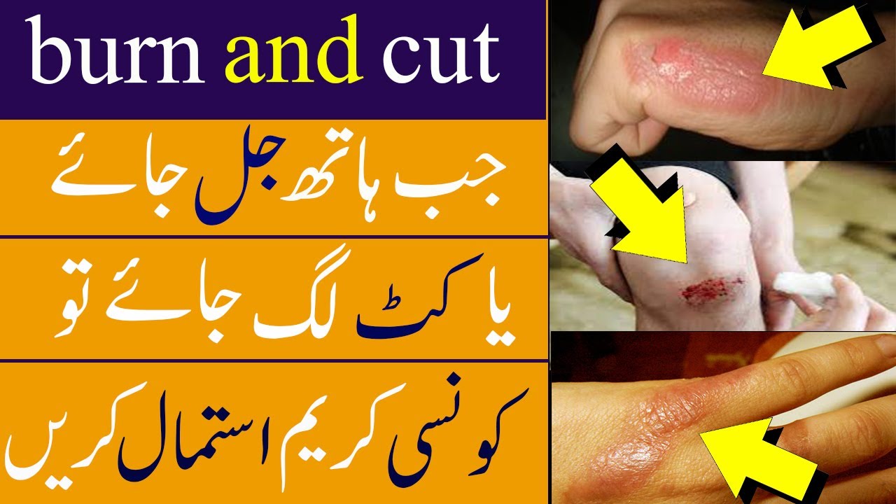 best cream for fungal infections cut and burn antifungal medications