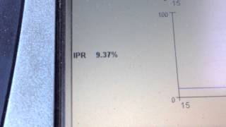 P1211, lack of power on a Ford 7.3 powerstroke diesel. Due to oil.