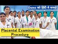 Placental examination demo fetal surface maternalumbilical cord examinationprocedure