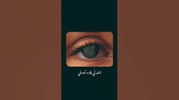 أنا أصلا مشكلتي في عينها 