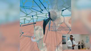 Kinomatic 3D Hip Surgery Technology