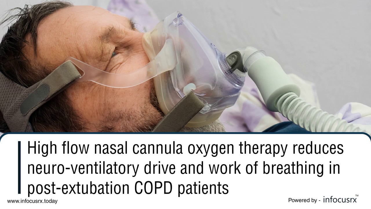 Nasal cannula oxygen therapy reduces neuro ventilatory drive & work of