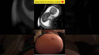Baby kick in mother womb ♥️? Embryonic Development ?pregnancy cutebaby fetus baby kick