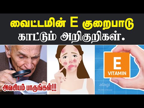 வைட்டமின் ஈ குறைபாடு அறிகுறிகள் |Vitamin E Deficiency Symptoms | Signs of Low Vitamin E |Health Tips