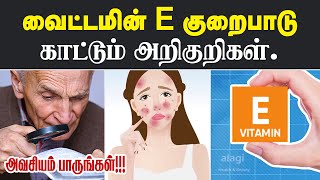 வைட்டமின் ஈ குறைபாடு அறிகுறிகள் |Vitamin E Deficiency Symptoms | Signs of Low Vitamin E |Health Tips screenshot 3