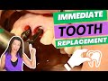 Immediate Tooth Replacement - Dental Implants on 8 & 9