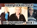 TUMMY TUCK SERIES: EPISODE 2 - DAY OF SURGERY + WEEK 1 OF RECOVERY