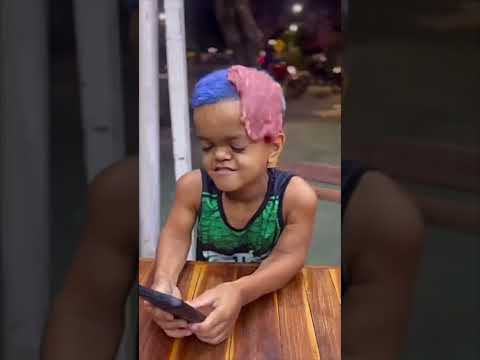 مرحبا بك أيها القزم 