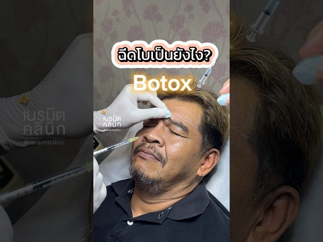 ฉีดโบเป็นยังไง? ตัวยาทำงานยังไง? 💉✨ | Botox #เนรมิตคลินิก