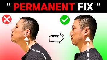 Can You Fix Your Forward Head Posture in Just 5 Minutes a Day?