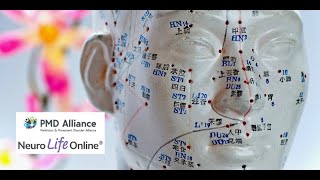 Neuropuncture: A Neuroscience Acupuncture Approach to Parkinson's Disease