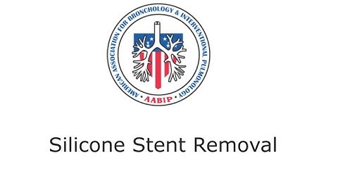 Silicone stent removal FINAL