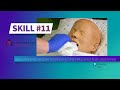 Lacc  cna skill 11  gives modified bed bath face and one arm hand and underarm