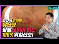 유산균 바로 끊어야 하는 위험신호!! 이런분들은 드시면 안됩니다.(유산균 부작용, 먹는시간)