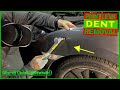 Paintless Dent Removal Technique To Repair a Large Fender Dent