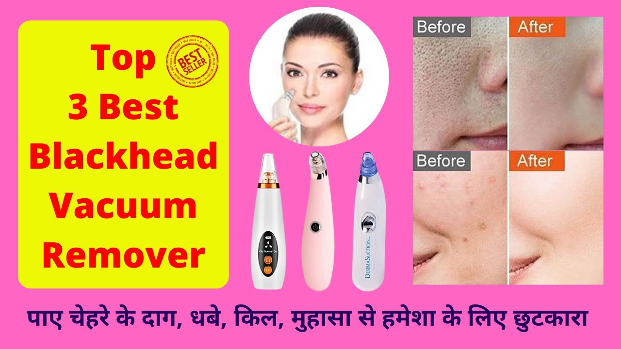 Top 3 Best Blackhead Vacuum Remover In India 2022 Best Selling Best