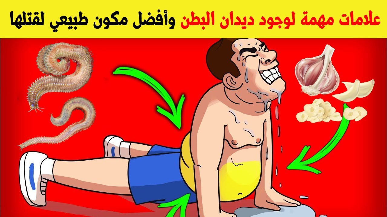 الديدان الكبار اعراض عند 2 من