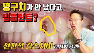 치아가 없으신 분 주목! 선천적 결손 치아 대처법 공개! (무조건 임플란트 하면 절대 안됩니다!)