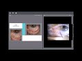 Plasma Assisted Non Invasive Surgery (PANIS Method) International Webinar by Dr. Farhad Nejat
