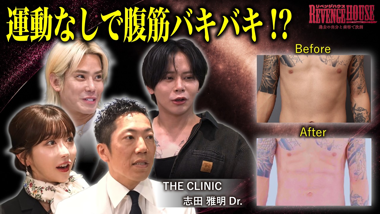 【Rちゃん絶賛】筋トレ不要で腹筋バキバキ！脂肪吸引の最後の砦が凄まじい【THE CLINIC】