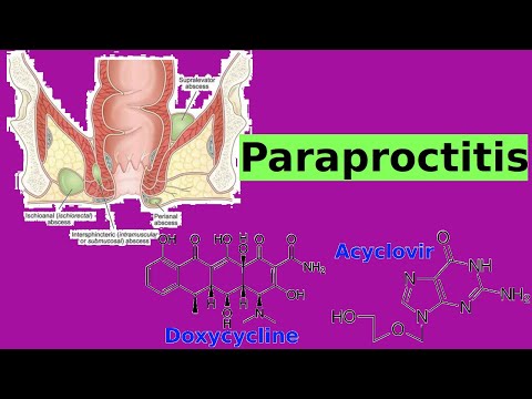 Video: Paraproctitis - Oorzaken En Symptomen