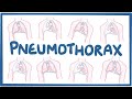 Pneumothorax - causes, symptoms, diagnosis, treatment, pathology