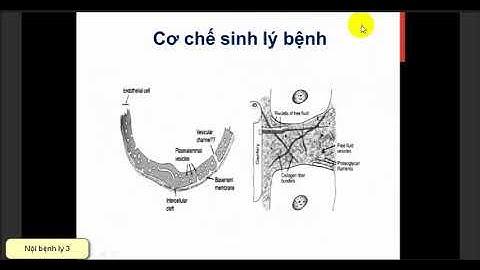 Những vấn đề cannf đánh giá ở bẹnh nhân sốc năm 2024