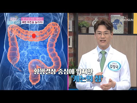장 건강 & 쾌변 부르는 마사지법은? [굿모닝 정보세상] 178회  20200325