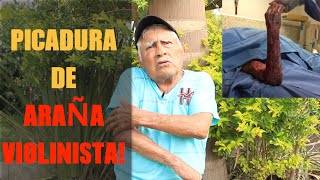 Entrevista a Don Margarito - Paciente con Picadura de Araña Violinista