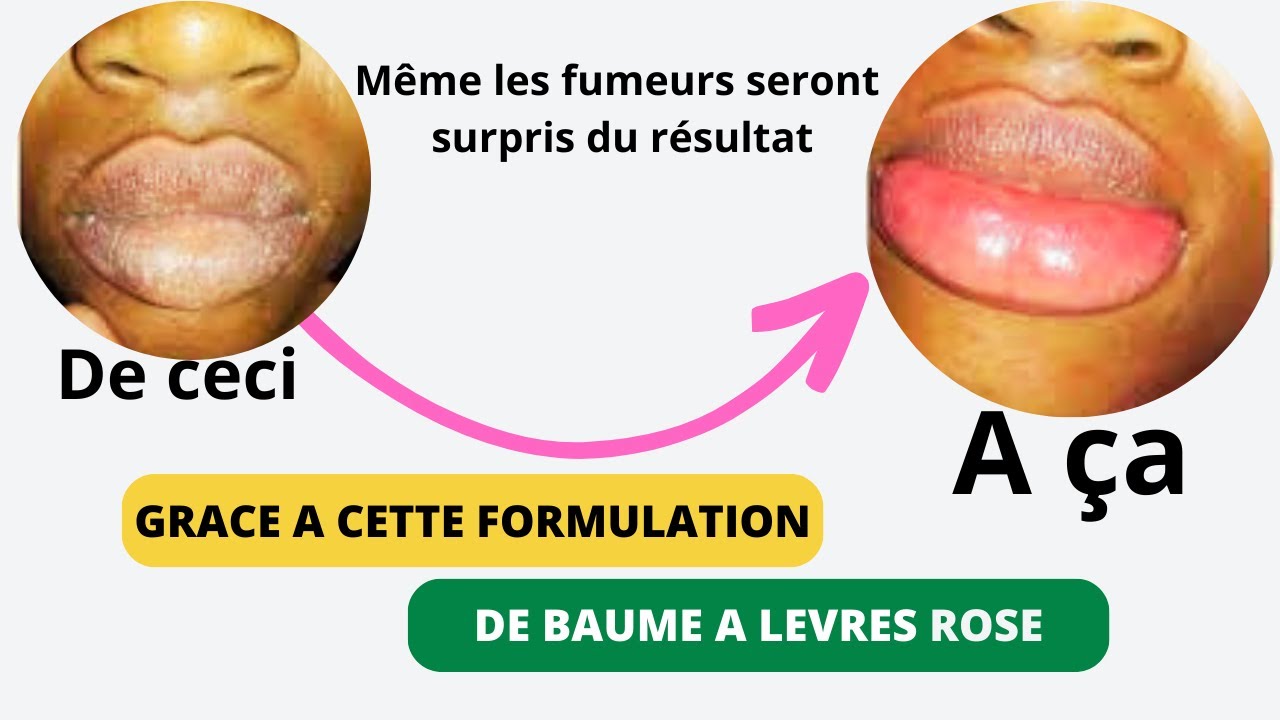 Lèvres roses garanties en 7 jours avec cette formulation - YouTube