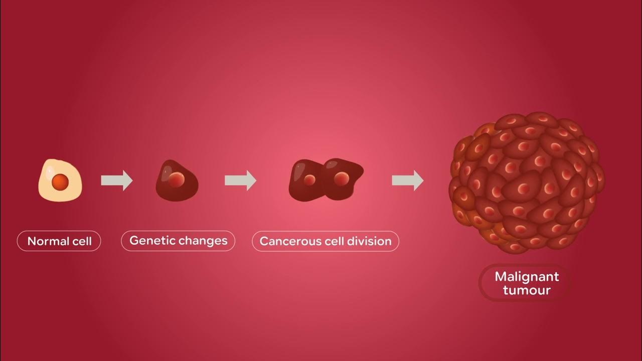 Can A Brain Tumor Kill You Instantly