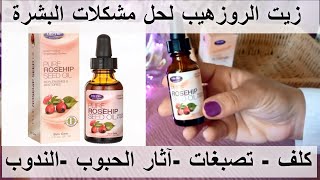 [Rose Hip Seed Oil ]علاج تصبغات البشرة ,آثار الحبوب , الندوب مع زيت الروزهيب