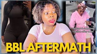 BBL AFTERMATH: Nobody Talks About What Happens After Surgery