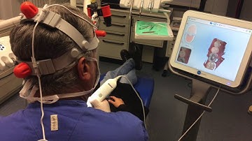 iTero element unboxing