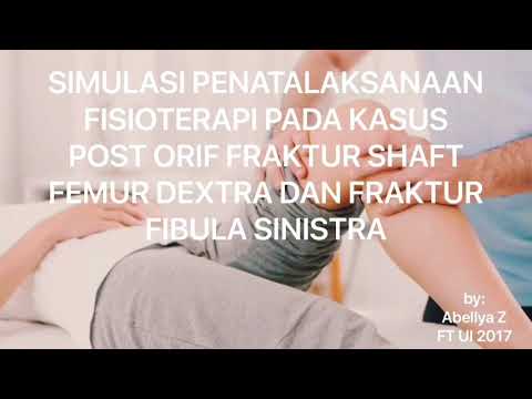 Video: Reduksi Dibantu Internal Dan Fiksasi Internal (ARIF) Versus Reduksi Terbuka Dan Fiksasi Internal (ORIF) Untuk Fraktur Plato Tibialis Lateral: Studi Retrospektif Komparatif