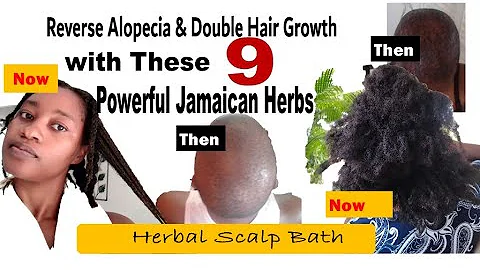 NO More Balding! Herbal Scalp Bath for Alopecia | 9 Powerful Jamaican Herbs #alopecia #hairloss