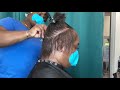 Alopecia Transformation | Traction Alopecia from wig wearing