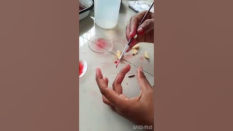 Anatomy of ficus Root #BOTANY#Practical#lab#B.sc#2-Semester#(Angiosperms)Short #video