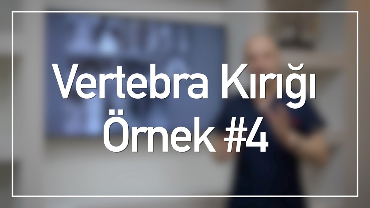 Çoklu Omurga Kırıkları | Vertebra Kırığı Vaka Örnekleri #4