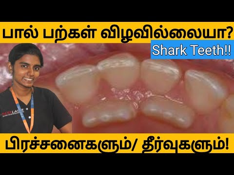 பால் பற்கள் விழுந்து நிலையான பற்கள் முளைக்க சரியான வயது Milk and permanent teeth eruption time tamil