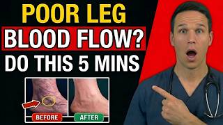 Poor Leg Circulation? 30-Second Test + 3 Fast Fix