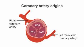 How To Find The Coronary Artery Origins Using Ct.