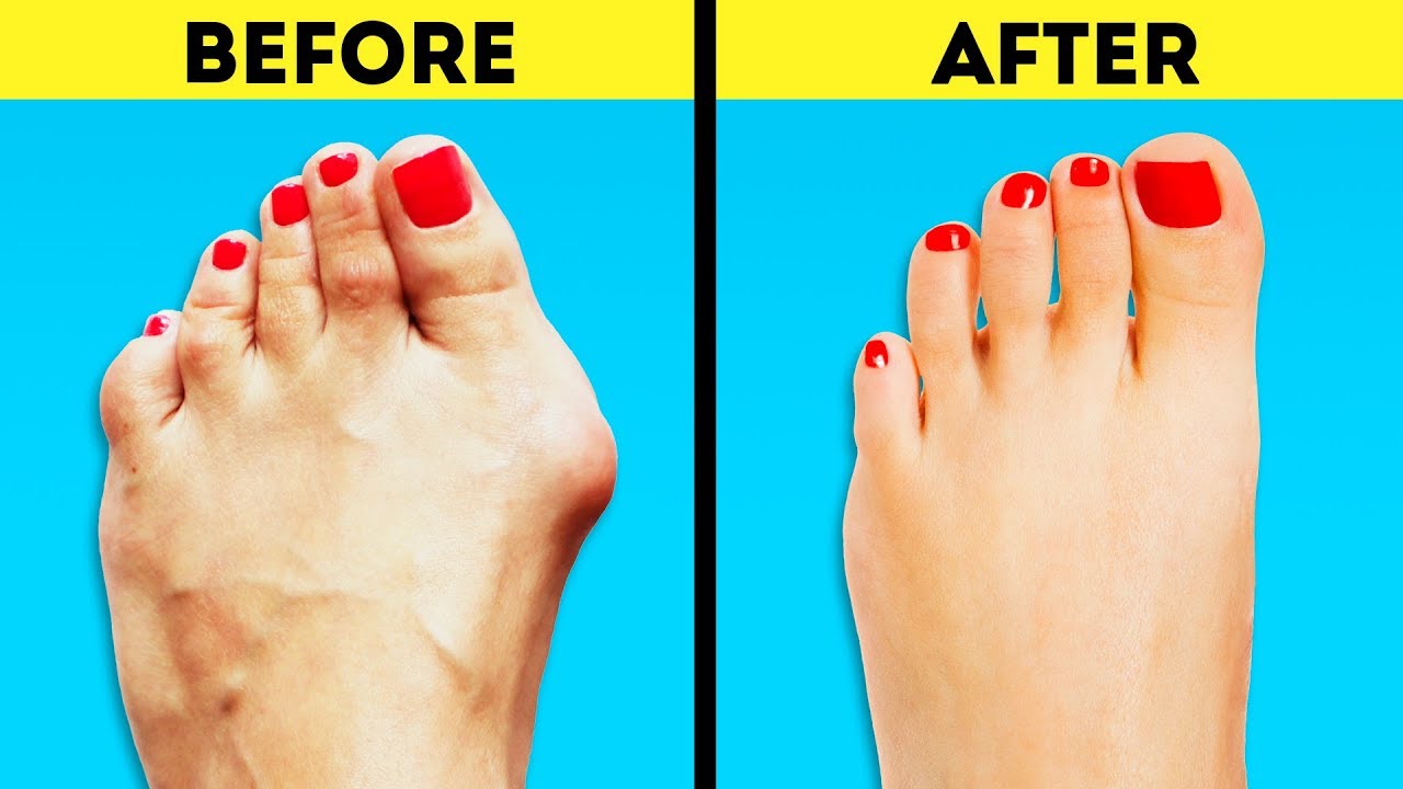 20 BODY HACKS TO MAKE YOUR LIFE SIMPLER